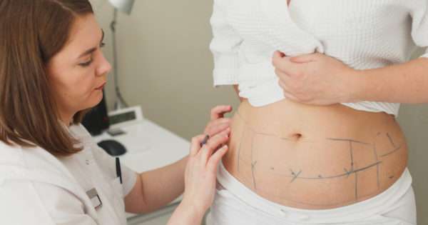 Everything you need to know about liposuction | Beanstalk Mums