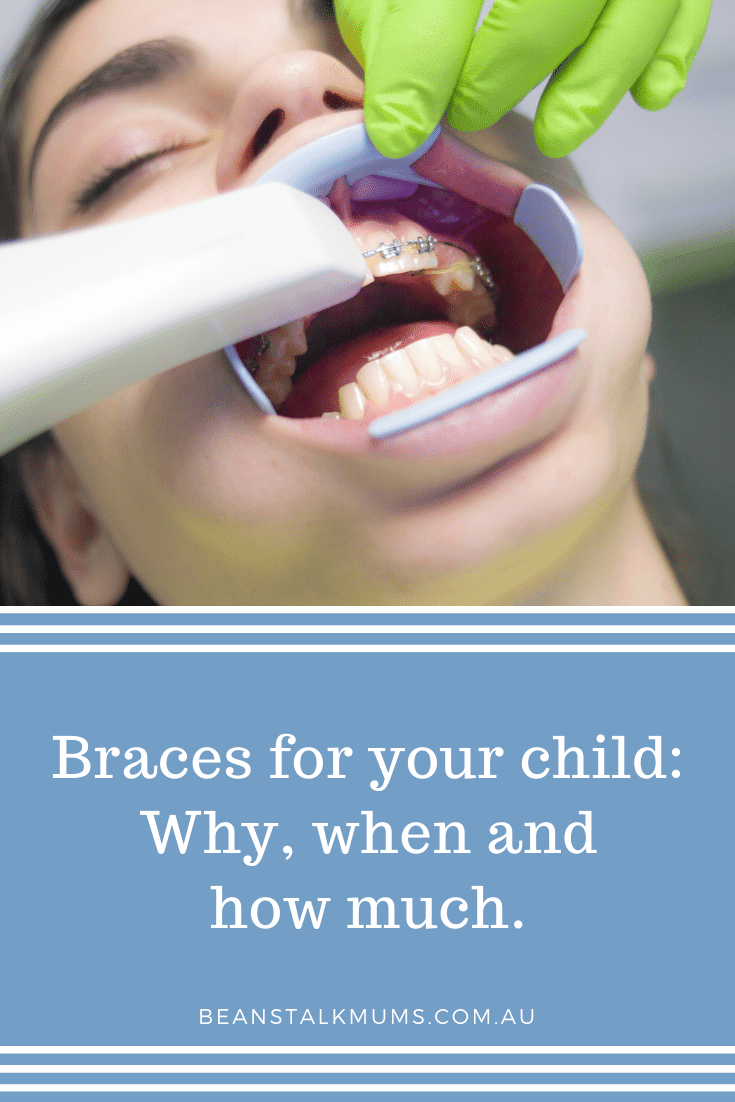 Braces for child: Beanstalk Single Mums Pinterest