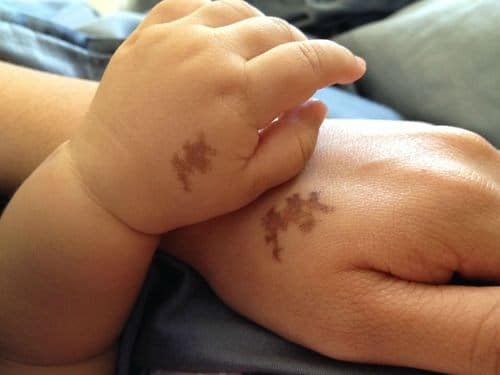 Childs birthmark tattoo